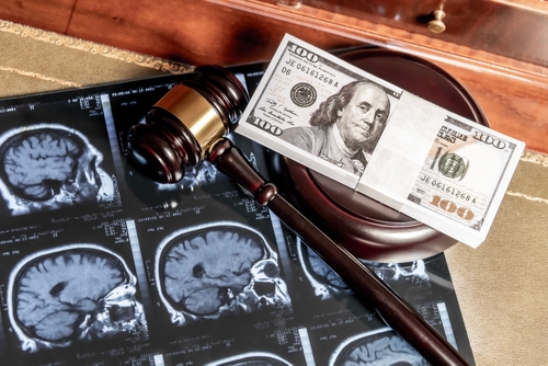 A judge’s gavel and cash placed on brain scan images representing brain injury settlements in legal cases.