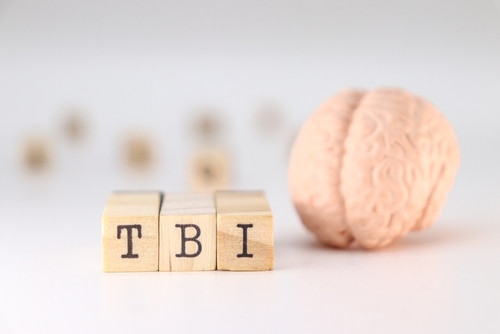 A close-up of wooden blocks spelling TBI next to a model brain, representing cases handled by an Ocala traumatic brain injury lawyer.
