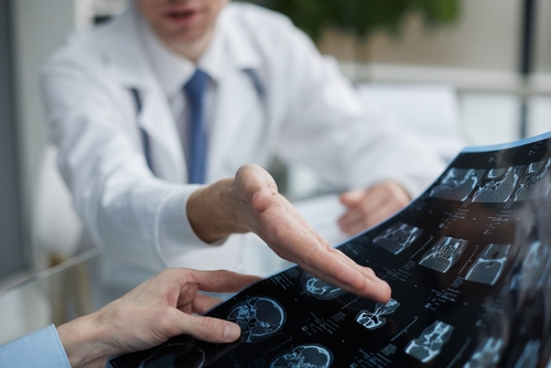 A doctor pointing to brain scan images while speaking with a patient, illustrating medical reviews involved in cases handled by an Ocala traumatic brain injury lawyer.